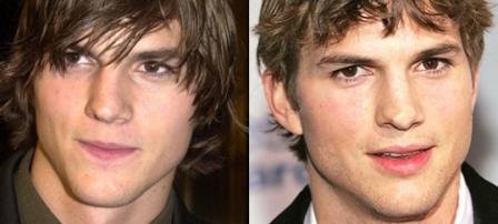Ashton Kutcher Crooked Nose