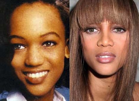 How Much Is a Nose Job - Trya Banks Nose Job