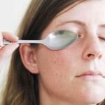 How to Get Rid of Dark Circles under Eyes - Cold Spoon