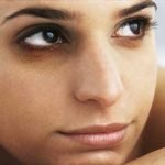How to Get Rid of Dark Circles under Eyes – Causes of Under Eye Cirlces