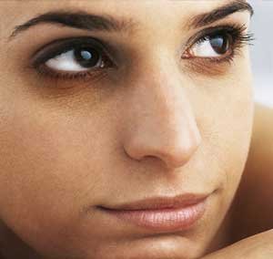 How to Get Rid of Dark Circles under Eyes – Causes of Under Eye Cirlces