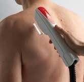 Laser hair removal from the back