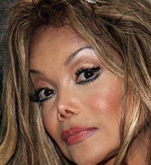 Rhinoplasty Gone Wrong