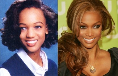 Tyra Banks Nose Job Before and After Photo