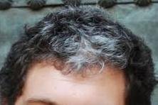 Young person with partial white hair