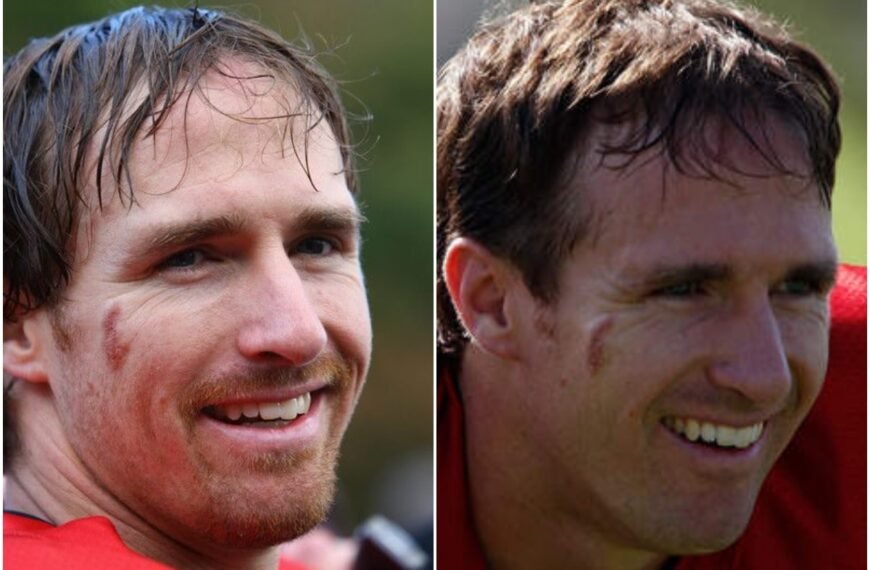 Drew Brees' Birthmark