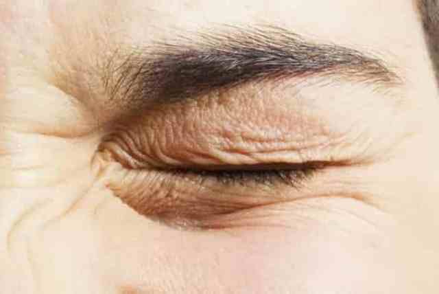 Left eye twitching/jumping, meaning, superstitions, bad omen